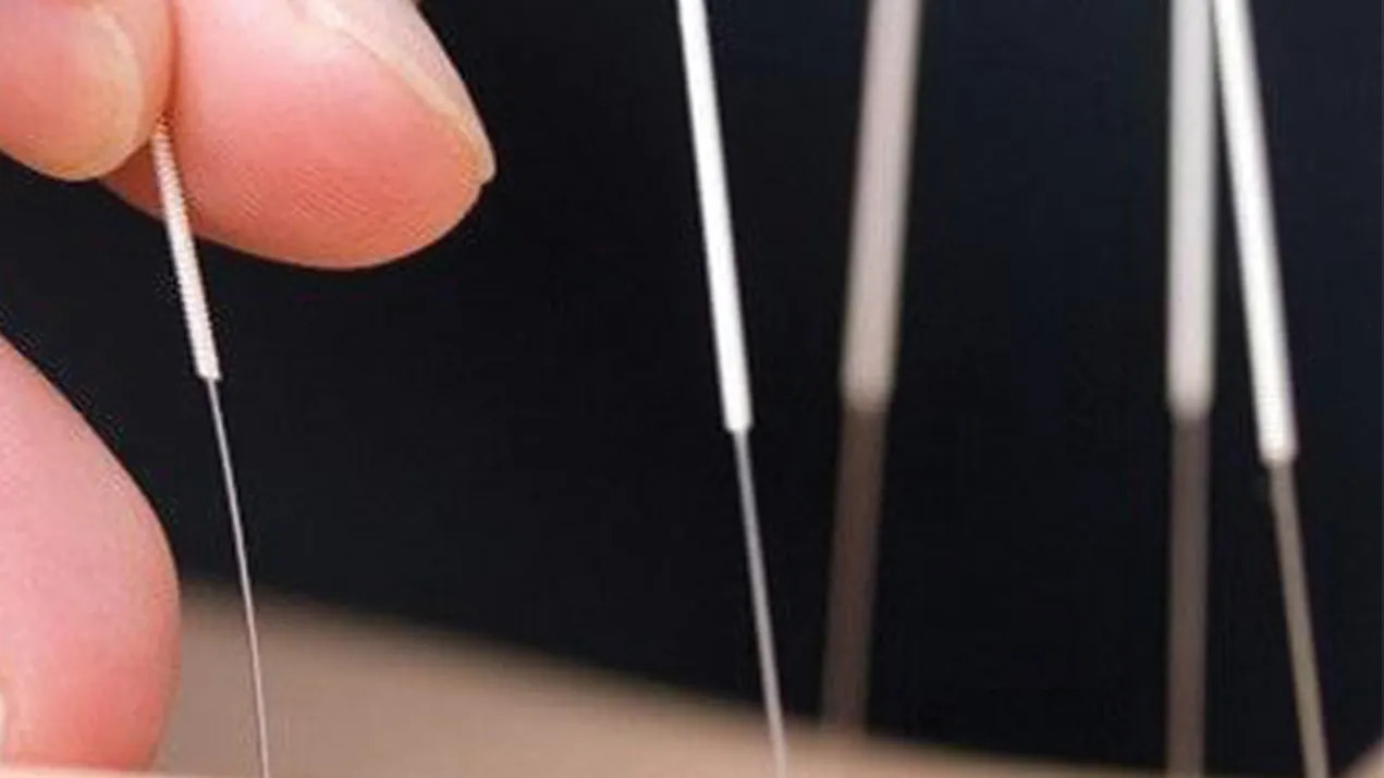 کلینیک طب سوزنی